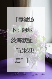 显微镜下：阿尔茨海默症“记忆重启”